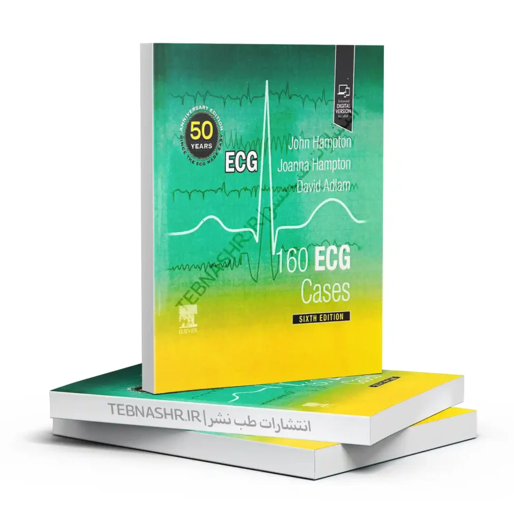 کتاب 160 ECG Cases – مجموعه کیسهای واقعی برای آموزش سریع و حرفهای تفسیر نوار قلب